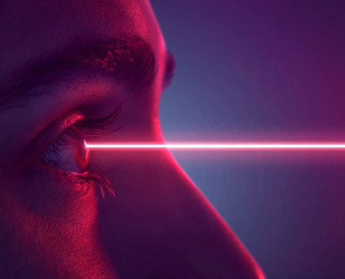 Chirurgia refrattiva - Vista Vision - trattamento laser occhi