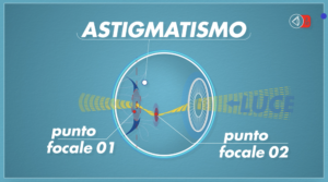 correggere l'astigmatismo