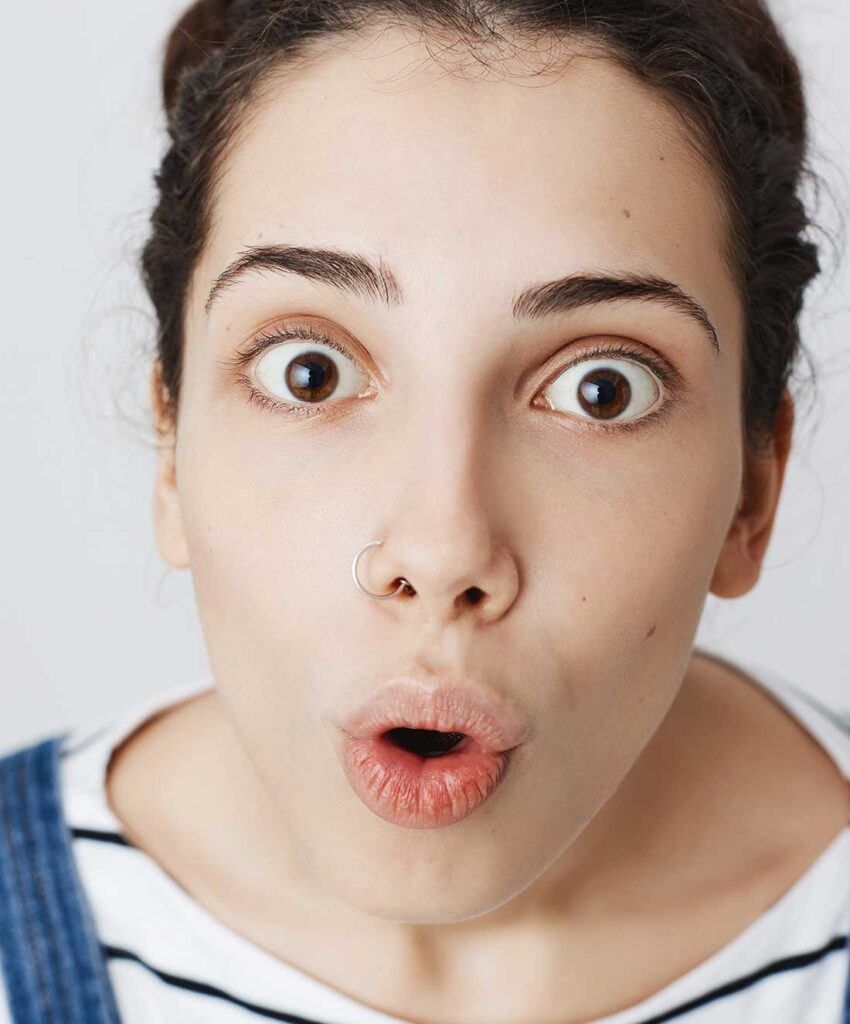 donna con occhi sporgenti per oftalmologia distiroidea