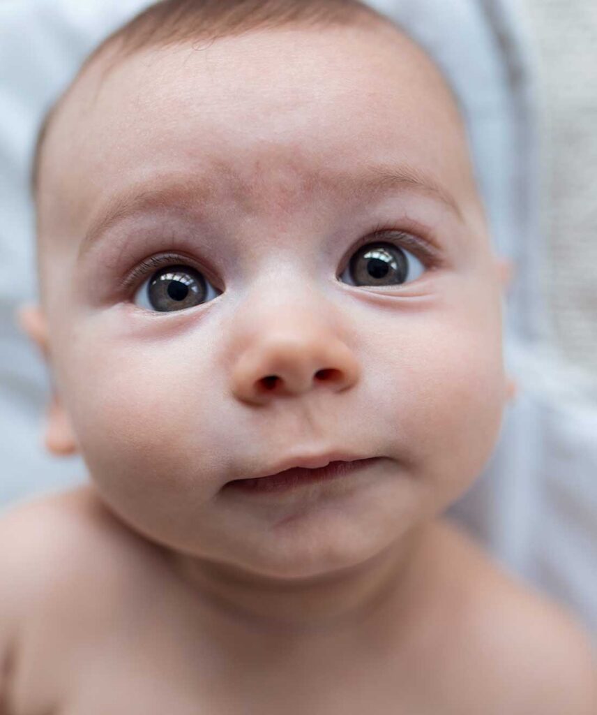 neonato con ostruzione delle vie lacrimali