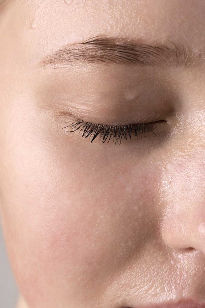 palpebre chiuse di donna con una patologia alle palpebre