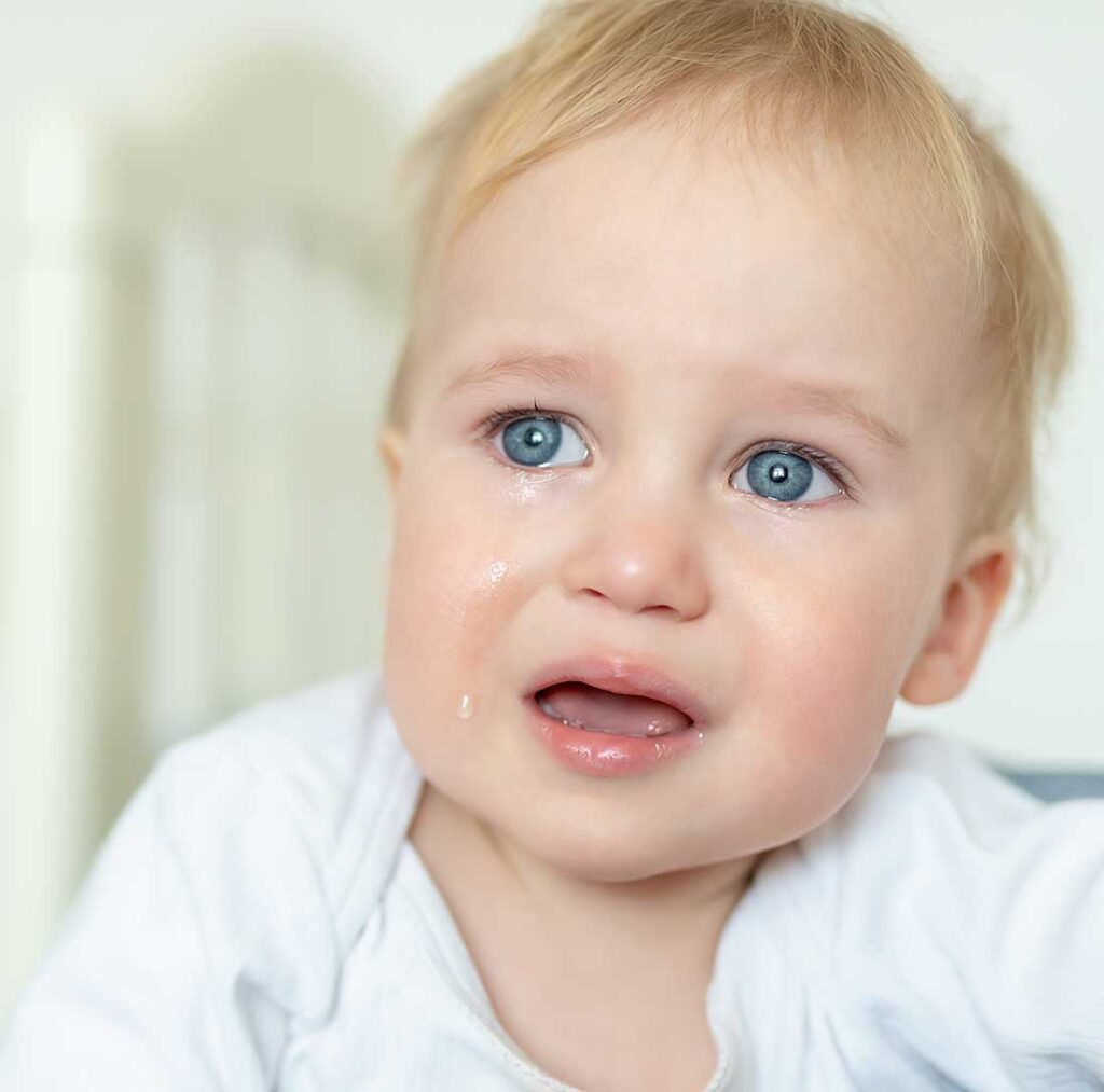 bambino con lacrimazione eccessiva per ostruzione dei dotti lacrimali
