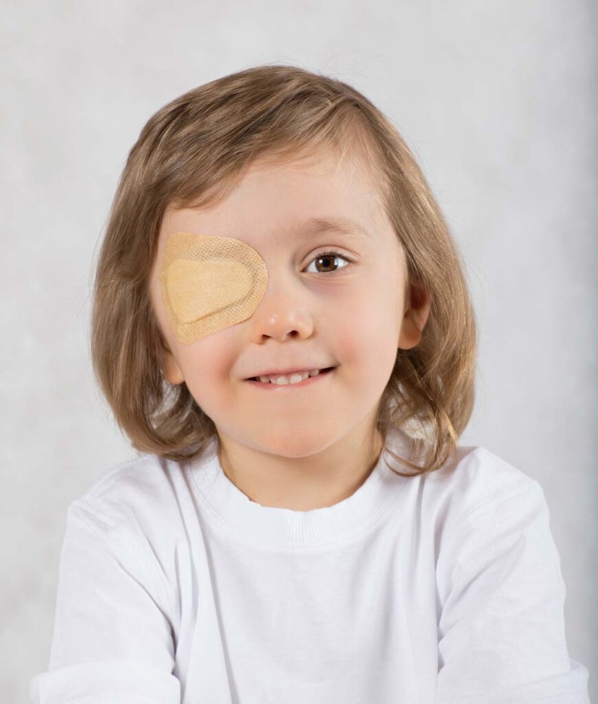bambino con cerotto per correggere ambliopia