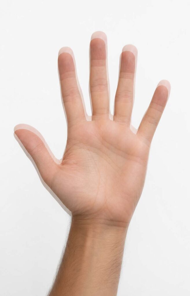 simulazione di visione con diplopia verticale