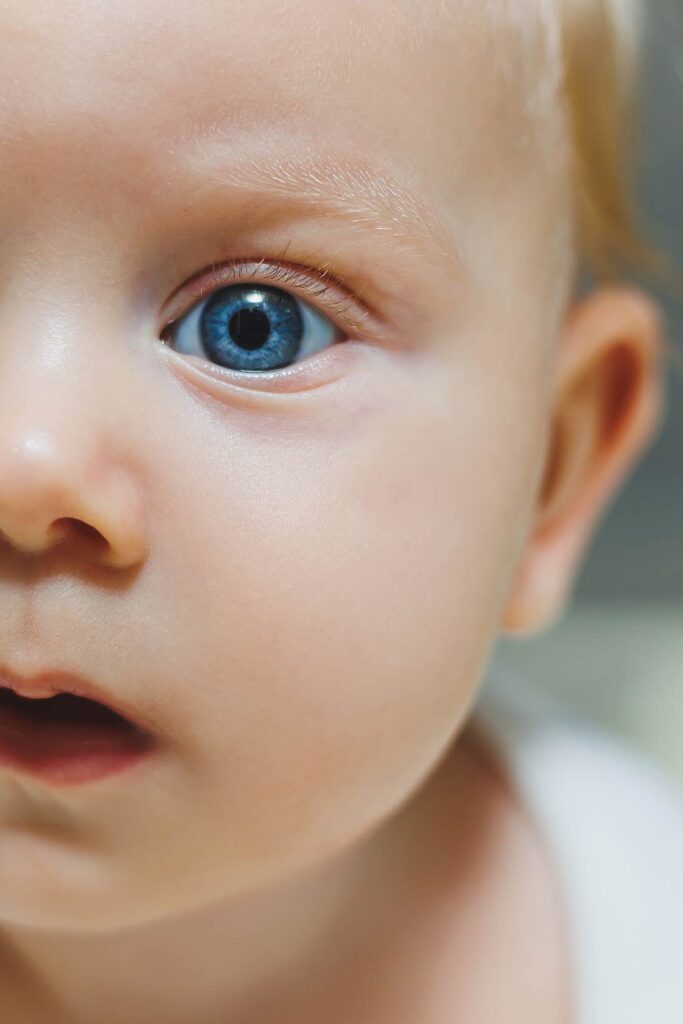 occhio di neonato con vascolarizzazione fetale persistente