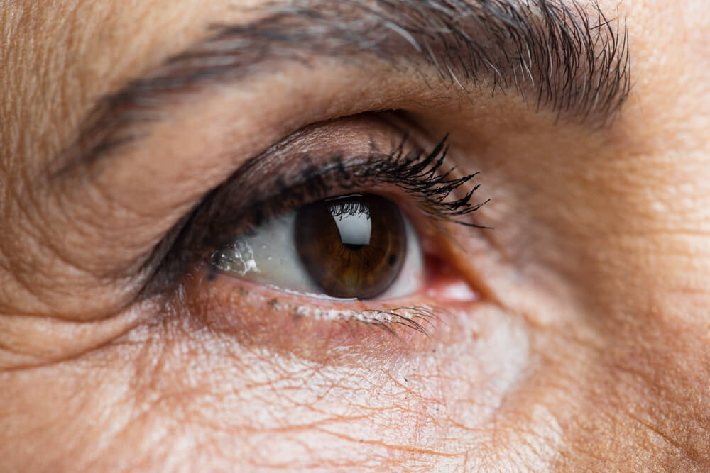 segnali del distacco retina
